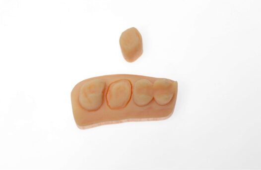 Digitaal afdrukken by Dental Labo Vanderbeken