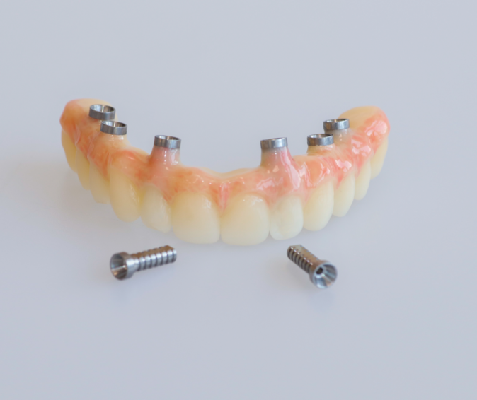 Gefreesde PMMA Brug Titanium Temporary Cilinders